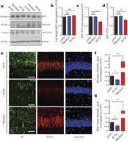 'Flashing light therapy' for Alzheimer