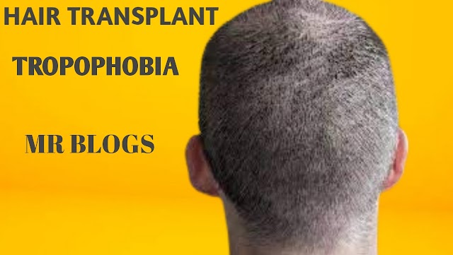 Hair Transplant Tropophobia - Tropophobia Treatment
