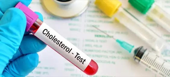 Cholesterol Calculation And Tests: A Key To Healthy Life