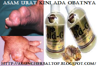 Obat Tradisional Penurun Atasi Kadar Asam Urat