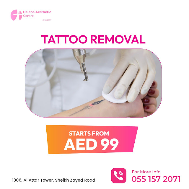 Laser Tattoo Removal Dubai