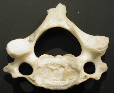 human neck cervical vertebrae bone