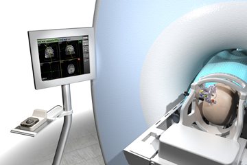 Brain monitoring equipment market