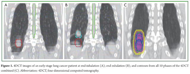 Improving radiotherapy planning, delivery accuracy, and normal tissue sparing using cutting edge technologies
