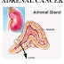 Adrenal cancer