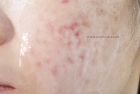 Cetaphil Gentle Skin Cleanser untuk kulit sensitif dan berjerawat