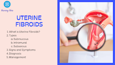 Uterine Fibroids - Definition, Types,Signs and Symptoms, Diagnosis and Treatment