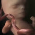 This Is How Your Baby Feeds From The Womb (Video)