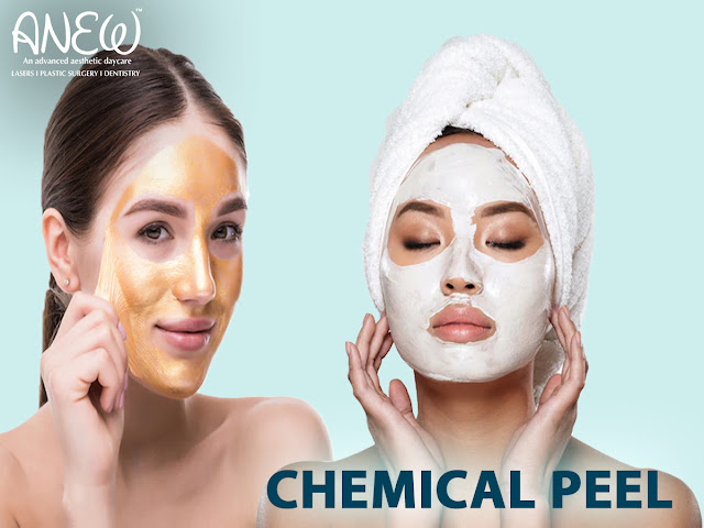 chemical peel in Bangalore