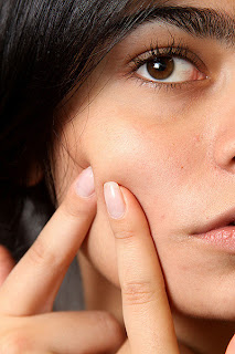 skin problem, acne, pimple, female, face, pinch