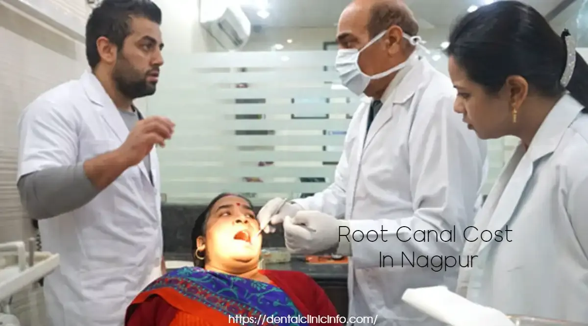Root-Canal-Cost-In-Nagpur