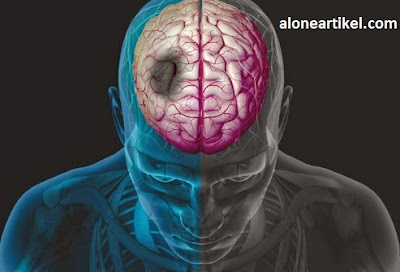 2 Hemispheres Of The Human Brain (2 Belahan Otak Manusia) 