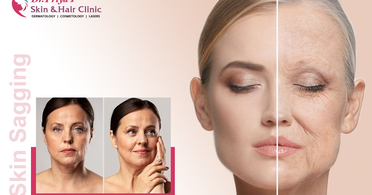 Finding the perfect clinic for skin sagging treatment in Bangalore