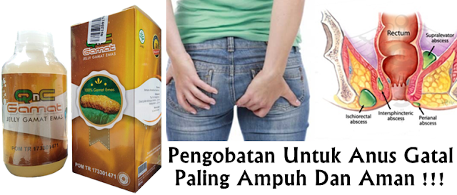 Pengobatan Untuk Anus Gatal