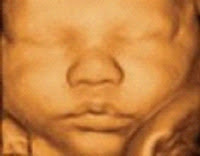 3d Ultrasound Images1