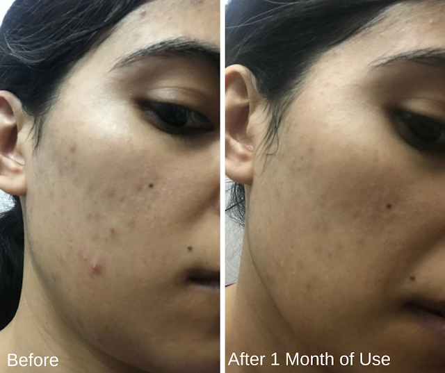 Klairs Product Review Before and After 2