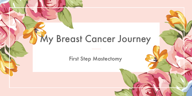 full mastectomy 