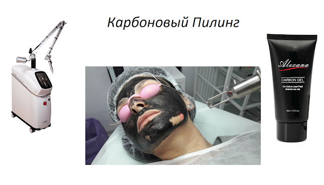 Карбоновый Пилинг Лица