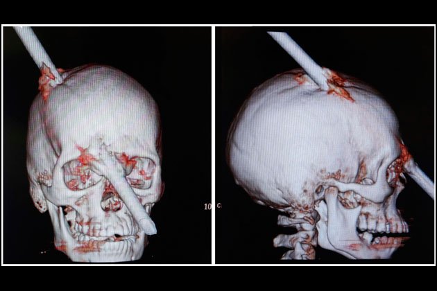 Foto-Foto Xray Yang Paling Mengerikan Hiii - Contoh Artikel Berita