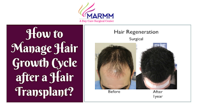 Hair Doctor in Indore, Hair Clinic in Indore