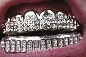 estos son glamubrackets y lo demás es cuento!!..