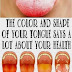 What Your Tongue Says About Your Health