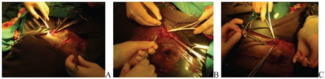 Teknik Operasi Colotomy Dan Colectomy pada Hewan (Bedah Sistma Digesti)