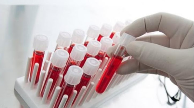 Πειραματικό καθολικό τεστ αίματος μπορεί να κάνει διάγνωση οποιουδήποτε καρκίνου μέσα σε μόνο δέκα λεπτά