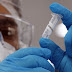 Infectologista diz que 30% dos exames PCR de covid-19 dão falso negativo