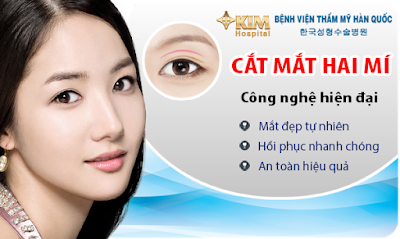 cắt mí mắt hàn quốc