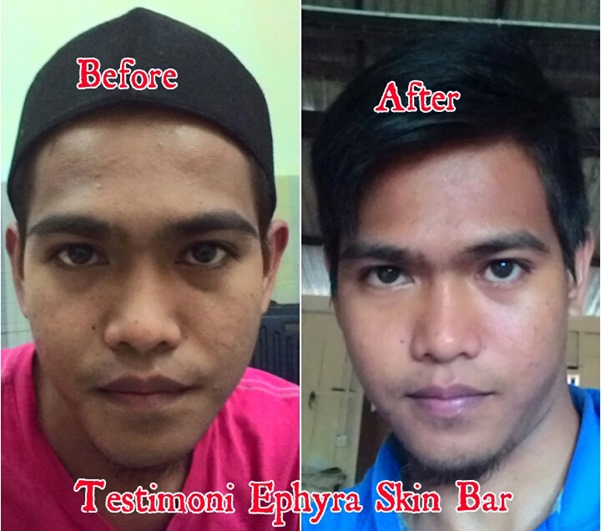 testimoni ephyra skin bar_1