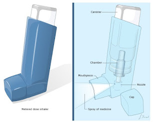 Metered-Dose Inhaler (MDI)