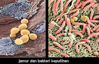 Obat Herbal Keputihan Pada Anak Yang Alami