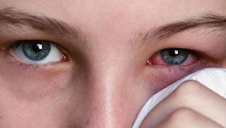 Eye pain medications by cause