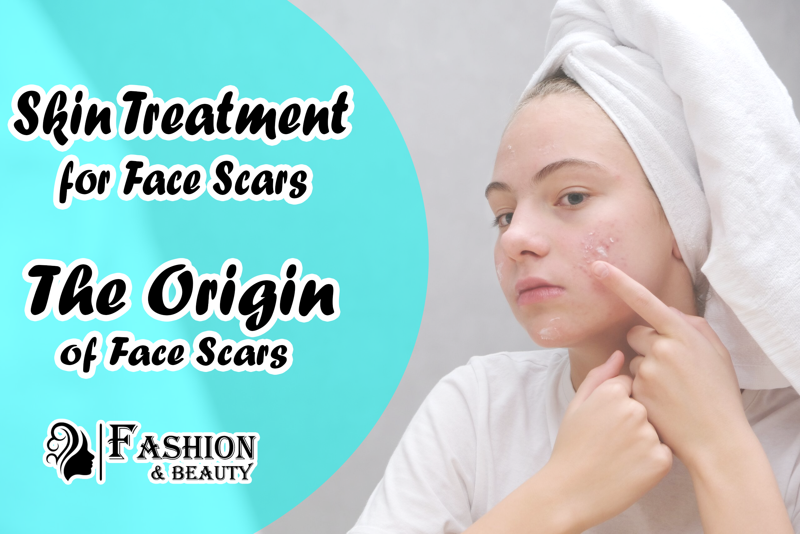 Skin Treatment for Face Scars