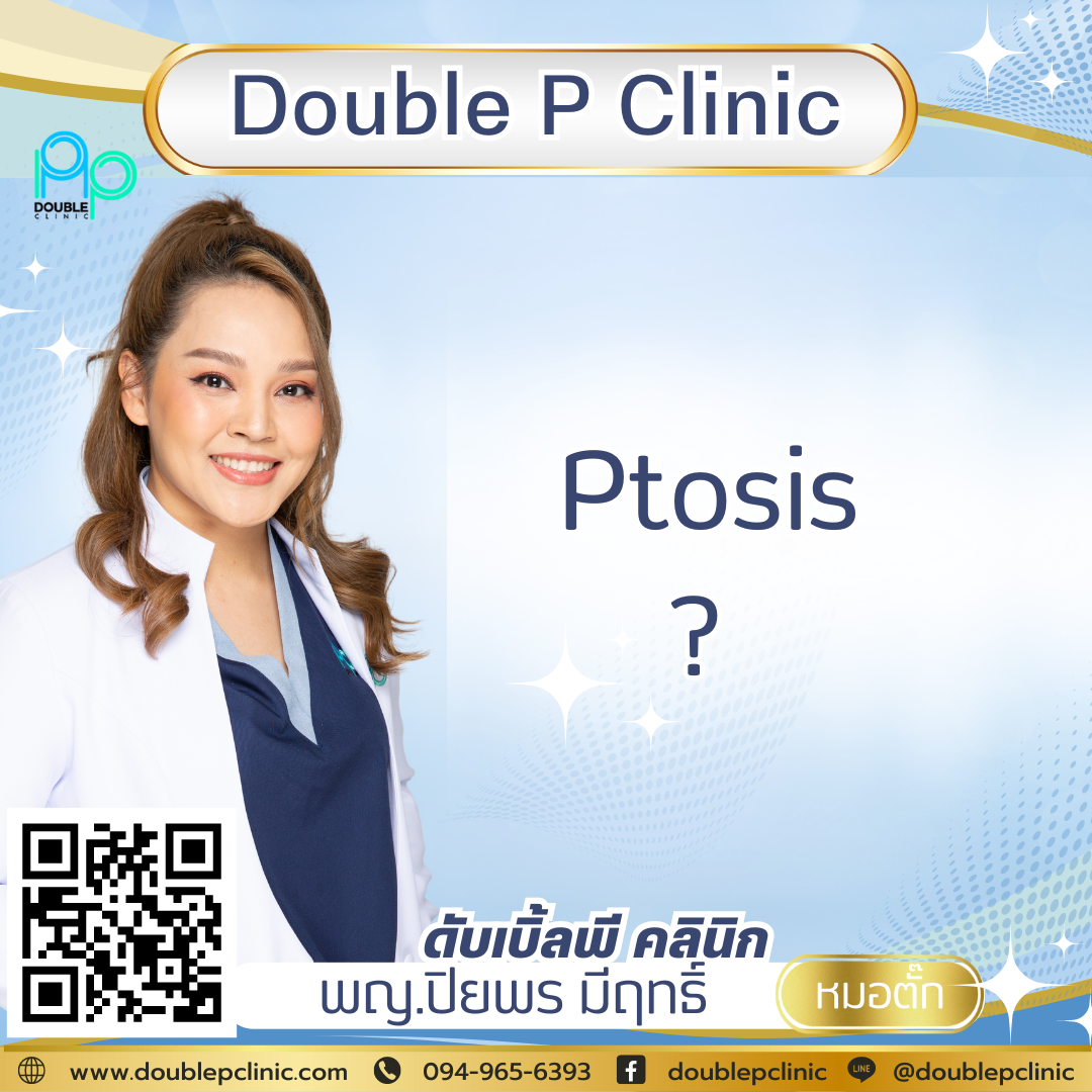 Ptosis