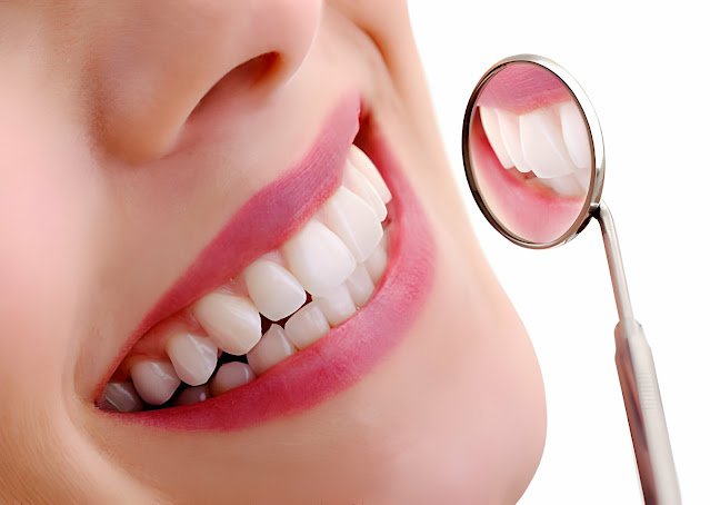 Close-up view of a healthy white smile, reflecting the benefits of oil pulling with castor oil for oral hygiene