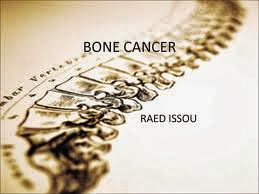 Bone cancer, can be exposed Young Parents