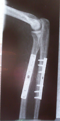 Orthopaedic Specialist skeleton muscle
