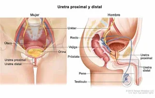 CÁNCER DE VEJIGA