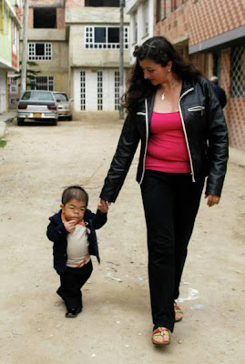 World's Shortest Man