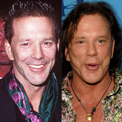 mickey rourke before plastic surgery