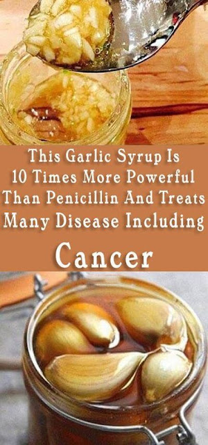 This Garlic Syrup Is 10 Times More Powerful Than Penicillin And Treats Many Disease Including Cancer