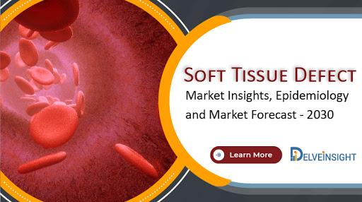 Soft Tissue Defect market