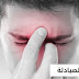 أسباب وعلاج احتقان الانف