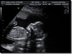 baby_11