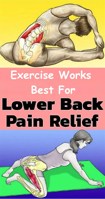 Disregard The Gizmos: Exercise Works Best For Lower-Back Pain