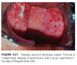 THE PATIENT WITH CHRONIC MULTIPLE LESIONS