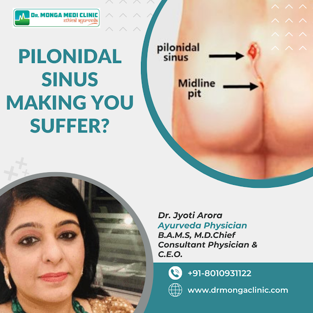 Pilonidal Sinus Treatment