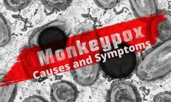 Monkey Causes and Symptoms